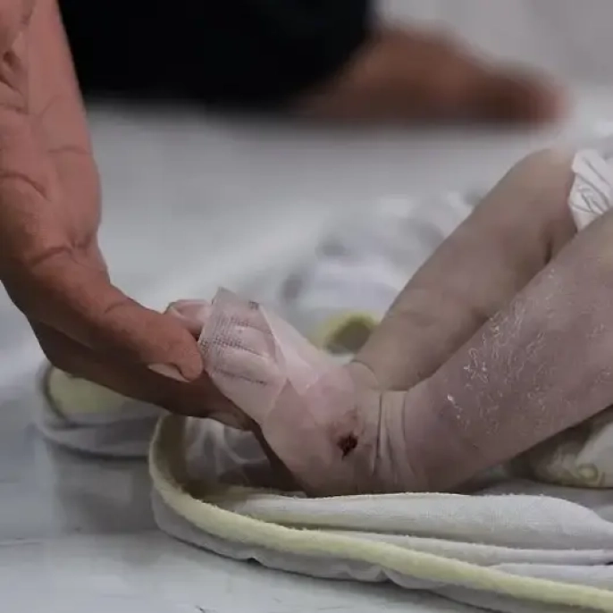 Ateşkes olmasına rağmen Gazze'de 37 çocuk hayatını kaybetti: UNICEF'ten şok rapor