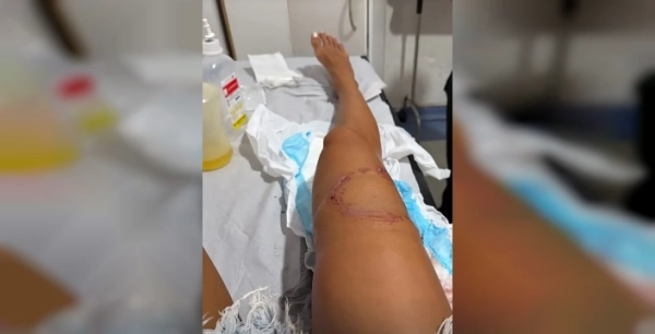 Sosyal medya fenomeni köpek balığı saldırısında yaralandı
