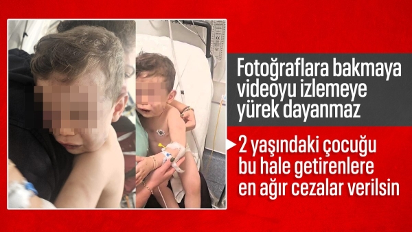 Denizli'de 2 yaşındaki bebek öldüresiye darbedildi