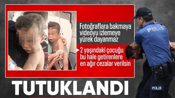 Denizli'de bebeği acımasızca darbeden şüpheli tutuklandı