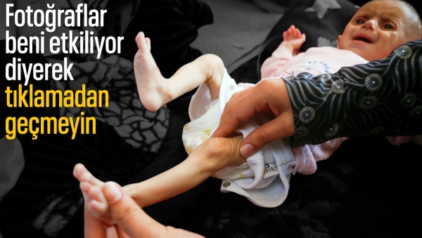 Gazze'de acı tablo: Açlık krizi derinleşiyor