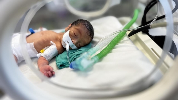 Gazze'de biri bebek 2 çocuk daha açlıktan hayatını kaybetti