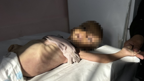 Gazze'de son 24 saatte 11 kişi açlıktan hayatını kaybetti