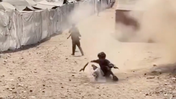 Gazzeli çocuk, İsrail'in hava saldırısında şarapnel parçasıyla yaralandı: Ölümden döndü