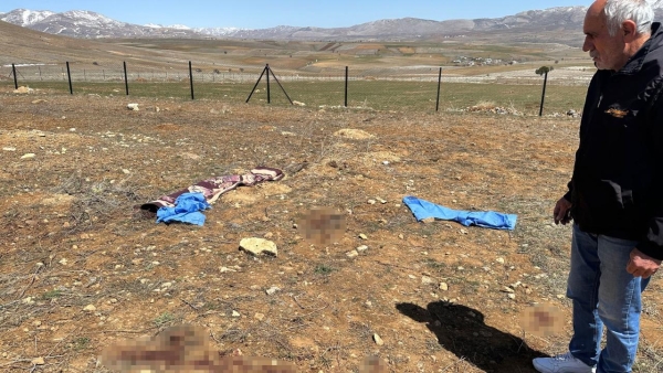 Kayseri'de başıboş köpeklerin saldırdığı kişi hayatını kaybetti