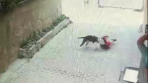 Sokakta oynayan çocuğa pitbull saldırdı