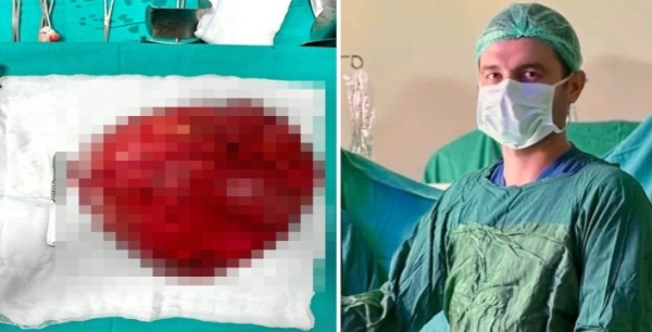 Akşehir'de görme engelli hastadan 40 santimetre büyüklüğünde kitle alındı