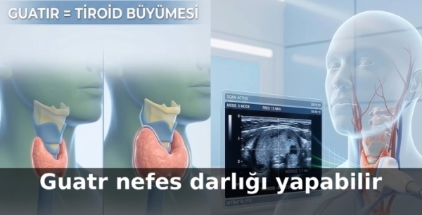 Guatr nefes darlığı yapabilir