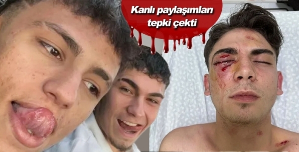 Konya’da kör eden muştalı saldırıya tahliye: Karara tepkiler yükseliyor