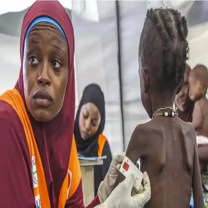 Somali'de milyonlar açlıkla boğuşuyor: Kuraklık ve çatışmalar felaketi büyütüyor!